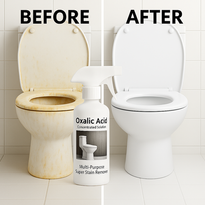 🔥 BUY 1 GET 1 FREE 🔥  Multi-Purpose Oxalic Acid Stain Removal Spray