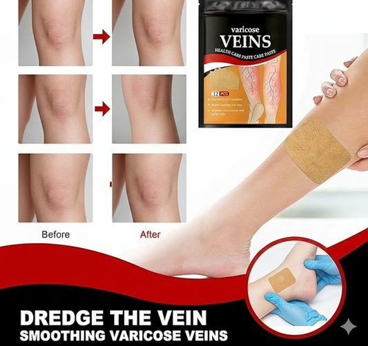 Varicose Veins Treatment Patch (12 Pcs) - 50% OFF